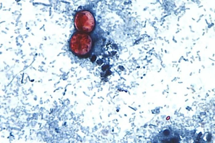 Những người nhiễm Cyclospora cuối cùng sẽ thải ra ngoài phân các dạng ấu trùng của ký sinh trùng gọi là nang trứng (oocyst). Hình ảnh hiển vi ở trên cho thấy một số nang trứng được tìm thấy trong mẫu phân. (Ảnh: CDC)