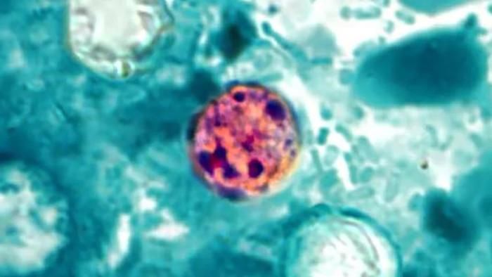 Hình ảnh hiển vi của Cyclospora cayetanensis trong phân. (Ảnh: CDC)
