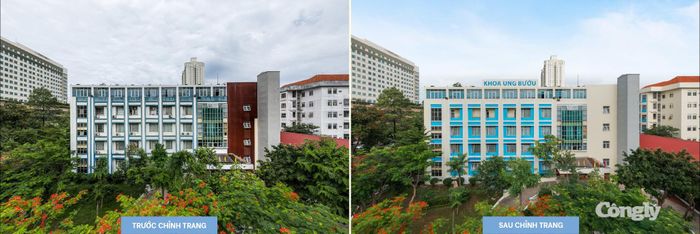 Bà Trần Thị Lan (48 tuổi, ngụ TP Đồng Nai) chia sẻ không gian mới của bệnh viện tạo cảm giác thân thiện và bớt áp lực cho cả người bệnh lẫn thân nhân. Chị cho rằng việc cải tạo cảnh quan, lối đi và khu vực chờ là những thay đổi thiết thực, góp phần nâng cao trải nghiệm trong thời gian điều trị.