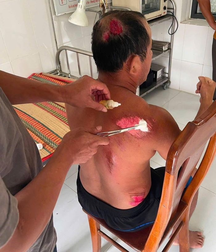 Anh Quyền được sơ cứu vết thương.