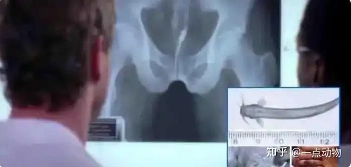Nước tiểu của con người có chứa urê và amoniac, dễ dàng thu hút cá tăm chui vào niệu đạo nếu con người vô tình đi tiểu dưới sông. Khi chui vào niệu đạo, gai nhọn của cá tăm sẽ ghim chặt vào thịt gây đau đớn, chảy máu và nhiễm trùng, chỉ có thể lấy ra bằng phẫu thuật y tế.