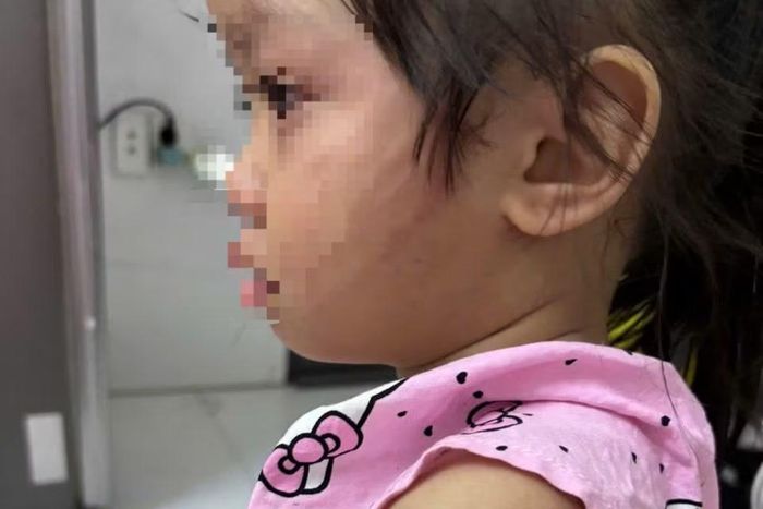 Những vết thương trên cơ thể bé gái được mẹ chụp lại, lưu giữ trước khi trình báo cơ quan chức năng.