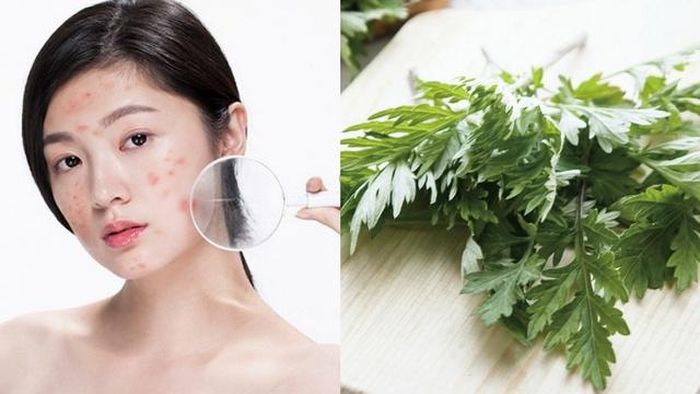 Bạn nên sử dụng thêm kem chống nắng khi điều trị mụn bằng ngải cứu. Chỉ nên thực hiện những cách trên từ 1 – 3 lần trong tuần.
