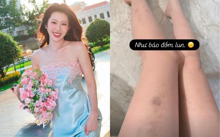 Tình trạng sức khỏe của Thúy Ngân khiến người hâm mộ không khỏi lo lắng. Ảnh: IGNV