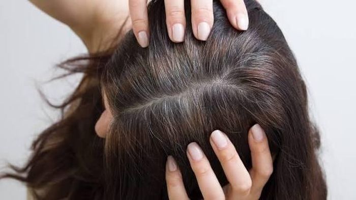 Tóc trắng mọc sau đầu. Ảnh minh họa.