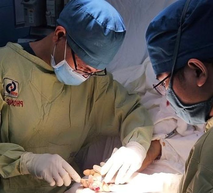 Ê-kíp bác sĩ Khoa Chấn thương Chỉnh hình thực hiện ca vi phẫu kéo dài gần 10 giờ