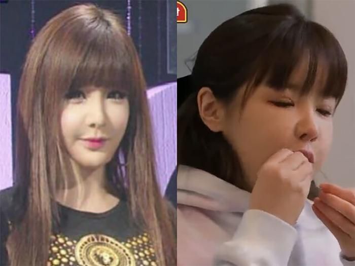 Park Bom từng vướng nghi vấn phẫu thuật thẩm mỹ khi ngoại hình thay đổi đáng kể so với thời còn hoạt động cùng 2NE1.