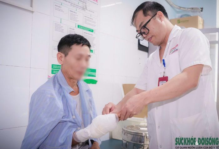 Bệnh nhân T.X.K. phải cắt tháo ngón tay cái bàn tay phải do hoại tử sau khi bị rắn hổ mang cắn.