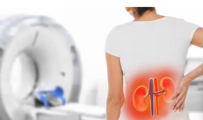 Bệnh thận mạn tính có xu hướng gia tăng rõ rệt cả trên thế giới và ở Việt Nam.
