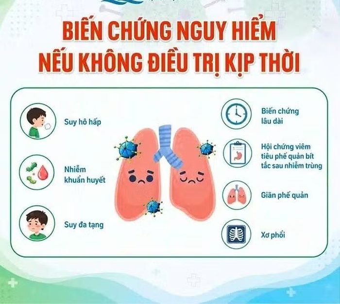Hình minh họa Bệnh viện Nhi TƯ cung cấp