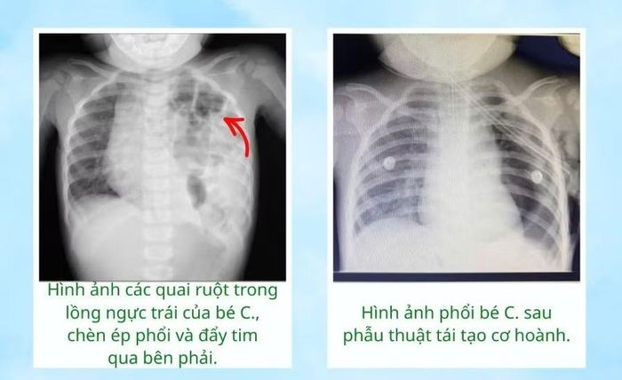 Hình ảnh X-quang hé lộ nguyên nhân bất ngờ - Ảnh BVCC