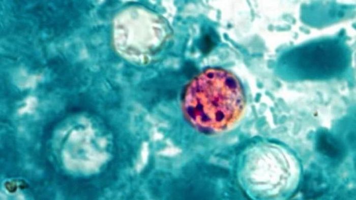 Hình ảnh ký sinh trùng Cyclospora qua kính hiển vi. Ảnh: CDC Mỹ