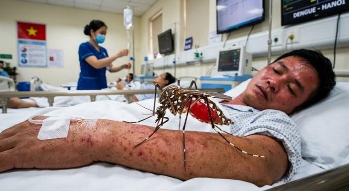 Sốt xuất huyết thường sốt cao đột ngột từ 39–40°C, sốt liên tục trong nhiều ngày và khó hạ bằng các biện pháp thông thường.