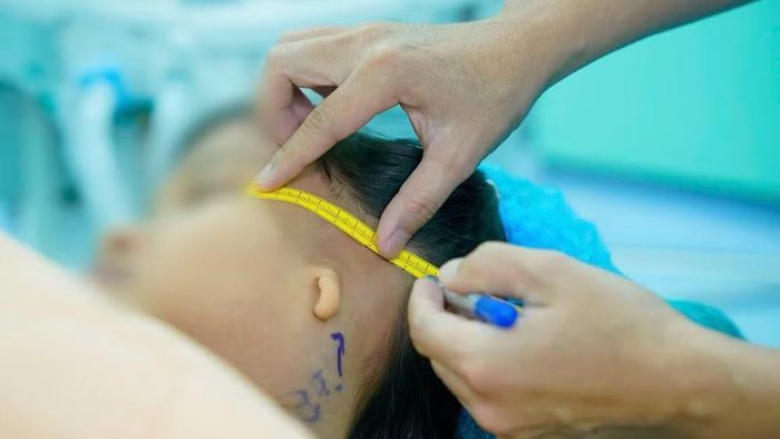 Bác sĩ đánh giá cấu trúc vành tai của bệnh nhi trước phẫu thuật.
