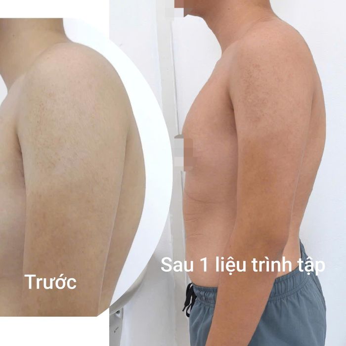 Hình ảnh bệnh nhân trước và sau liệu trình điều trị. Ảnh: Đặng Thanh