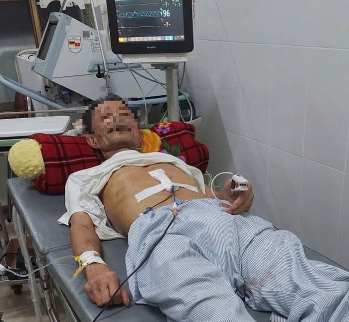 Hiện sức khỏe bệnh nhân ổn định, các chỉ số sinh tồn trở về mức an toàn. Ảnh: BVCC.