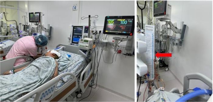 Bệnh nhi đang được cấp cứu. Ảnh: BSCC.
