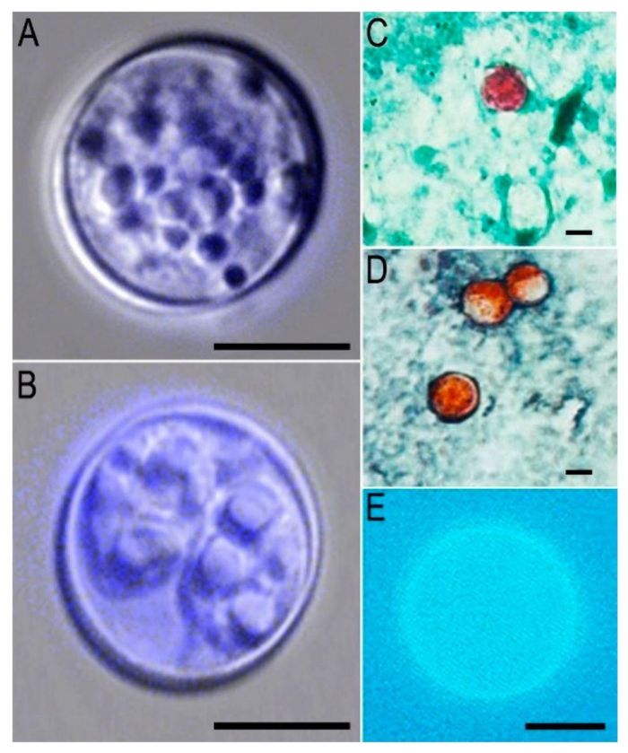 Các nang trứng (oocyst) của ký sinh trùng Cyclospora cayetanensis dưới nhiều kỹ thuật hiển vi và nhuộm khác nhau. Hình B cho thấy nang trứng đã ở giai đoạn sinh bào tử (sporulated), có khả năng lây nhiễm. Thanh tỷ lệ trong các ảnh A-E tương ứng 5 µm. Ảnh: Wikimedia Commons