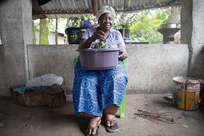 Một phụ nữ Liberia với đôi chân sưng phù, hậu quả của bệnh giun chỉ bạch huyết. Ảnh: Quỹ Anesvad