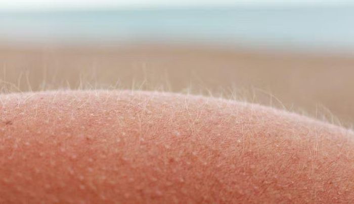 Lông tơ đào (lông măng) được phát hiện từ hơn 100 năm trước có liên quan mật thiết đến cơ chế gây ngứa.