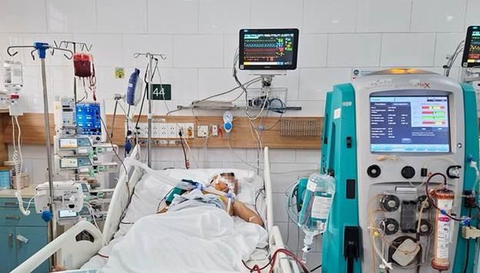 Người bệnh phải thở máy, lọc máu với tình trạng tan máu cấp. Ảnh: BVCC