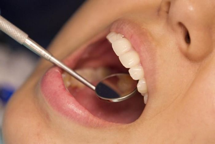 Các nha sĩ sẽ có thếm vai trò phát hiện sớm các dấu hiệu viêm nhiễm hệ thống và kịp thời hướng dẫn người bệnh đến các chuyên khoa tim mạch để tầm soát nguy cơ. Ảnh minh họa: AHA