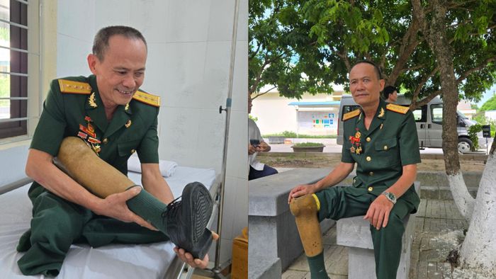 Thương binh Bùi Văn Tuyển đã gửi lại một phần thân thể nơi chiến trường khốc liệt.