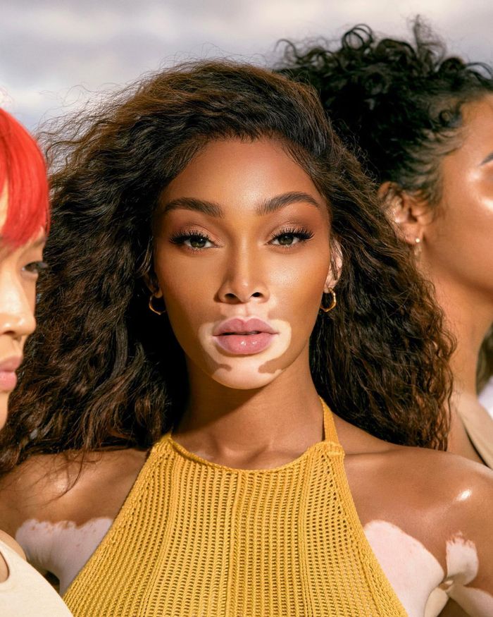 Ở tuổi 32, Winnie Harlow vẫn duy trì sức hút mạnh mẽ trong làng mốt.