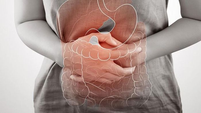 Chứng viêm ruột mãn tính (IBD) đang ảnh hưởng đến hàng triệu người trên toàn thế giới. Hình minh họa: Pelvic Specialists