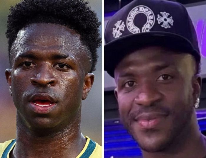 Hình ảnh trước và sau gây chú ý của Vinicius.