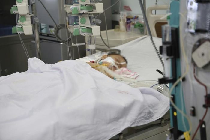 Bệnh nhi nhập viện trong tình trạng nguy kịch với 60 vết ong vò vẽ đốt. Ảnh: BVCC