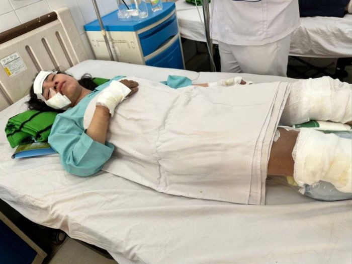 Nạn nhân vụ tai nạn được điều trị tại Bệnh viện Đa khoa Thống Nhất (TP Đồng Nai). Ảnh: XUÂN TRUNG