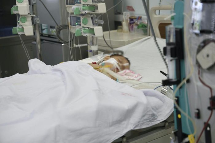 Bệnh nhi bị ong vò vẽ đốt trong những ngày nguy kịch. Ảnh: BVCC
