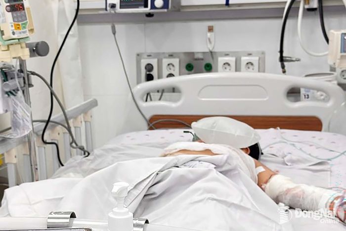 Một trong 2 bệnh nhi đang được điều trị tại Bệnh viện Nhi đồng 1 (Thành phố Hồ Chí Minh). Ảnh: BVCC