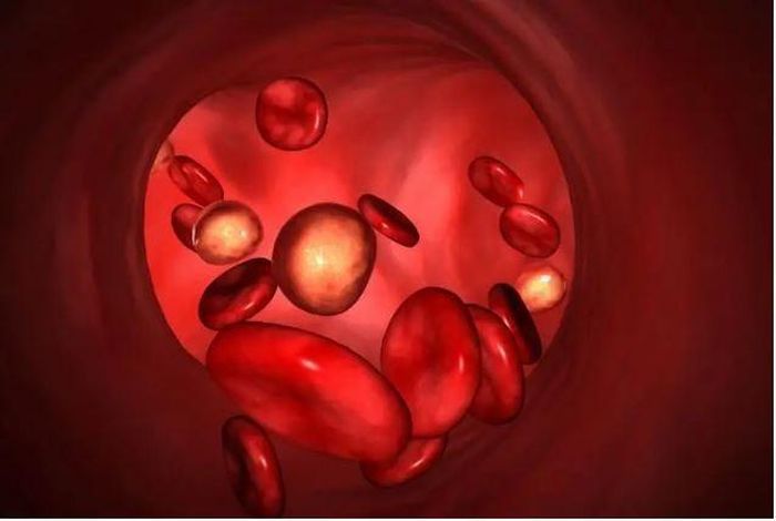 Khi thành mạch bị tổn thương, cholesterol và các chất béo trong máu có xu hướng lắng đọng nhiều hơn, từ đó thúc đẩy quá trình hình thành mảng xơ vữa. Ảnh minh họa