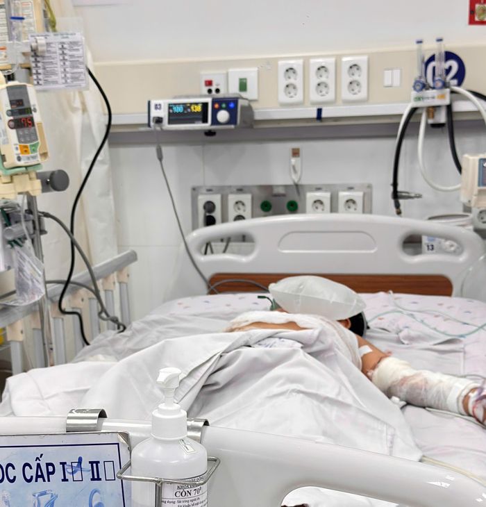 Bệnh nhi trong vụ cháy đang điều trị tại Bệnh viện Nhi Đồng 2. (Ảnh: BVCC)