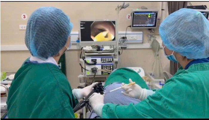 Các bác sĩ tiến hành gắp sán dây trong ruột bệnh nhân. Ảnh: BVCC