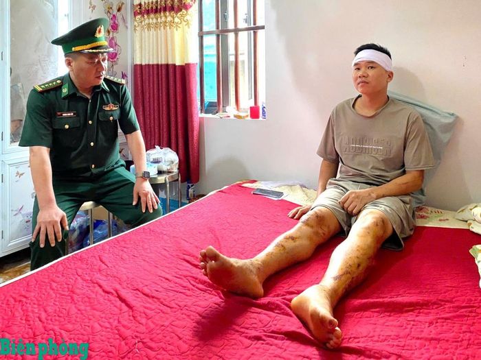 Đại tá Trương Minh Đức, Chỉ huy trưởng Bộ đội Biên phòng tỉnh Lai Châu động viên anh Nguyễn Thanh Hải. Ảnh: Đức Duẩn