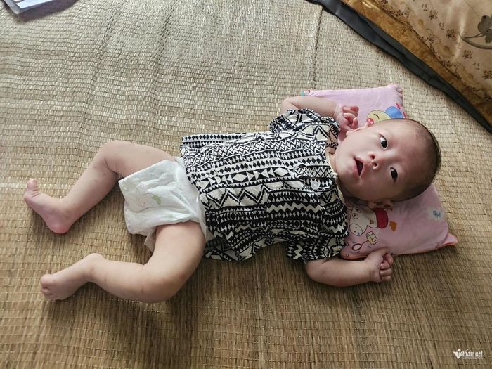 Đã 3 tháng nhưng cổ của em bé yếu, chưa tự ngẩng được đầu. Ảnh: Hải Sâm