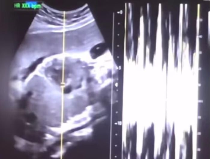Hình ảnh siêu âm thai nhi được người mẹ trẻ đăng lên mạng.