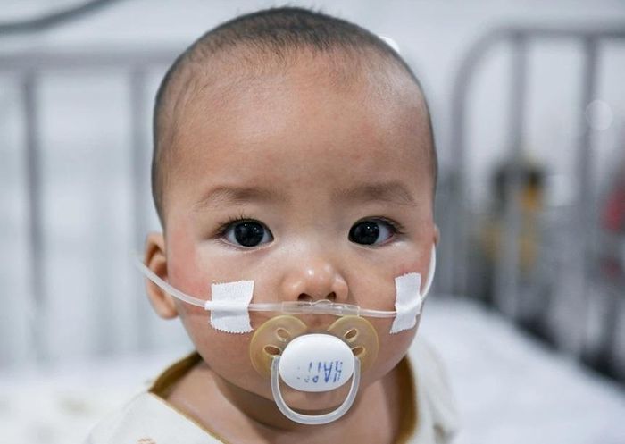 Bệnh nhi điều trị tại Bệnh viện Nhi đồng 1 (TP.HCM). Ảnh: Duy Hiệu.