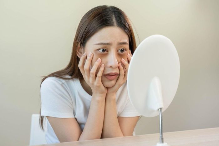  Vùng da quanh mắt vẫn sẫm màu, có xu hướng xanh tím hoặc đen và kéo dài trong nhiều tuần có thể cảnh báo gan có vấn đề. Ảnh: Shutterstock. 
