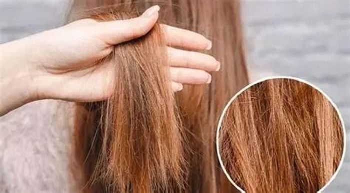 Tia UV có thể làm tóc khô xơ, mất độ ẩm và dễ gãy. (Ảnh: Minh họa)