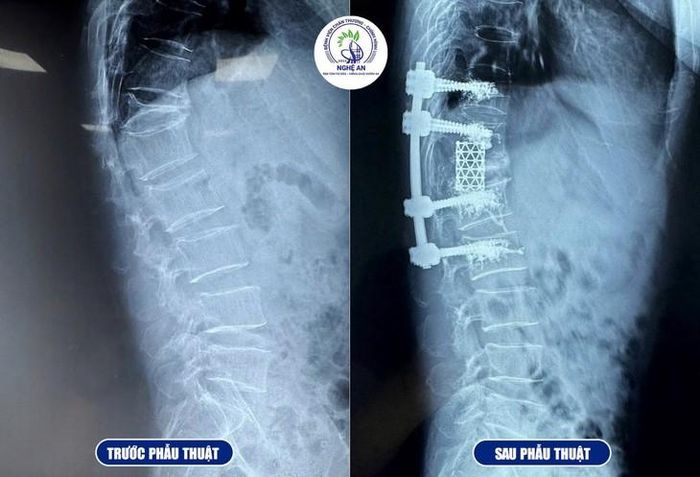 Hình ảnh trước và sau phẫu thuật. Ảnh: BVCC.