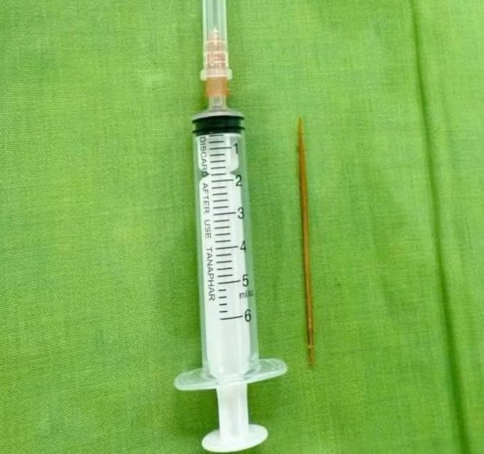 Chiếc tăm tre được lấy ra - Ảnh BVCC