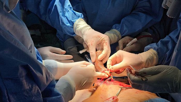 Ca ghép dương vật đầu tiên tại Việt Nam.