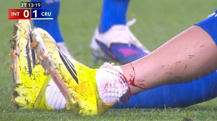 Chân của Gabriel Pec đổ máu sau va chạm.
