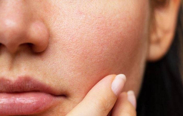 Làm sạch nhẹ nhàng giúp hạn chế kích ứng và giảm nguy cơ lỗ chân lông bị bít tắc.