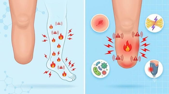 Đau chi ma được cảm nhận tại phần chân đã mất, trong khi đau mỏm cụt thường liên quan da, dây thần kinh, nhiễm trùng hoặc điểm tì của chân giả. Hình minh họa AI