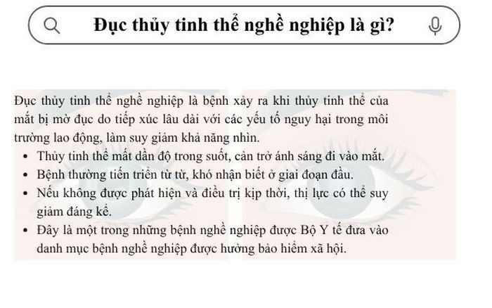 Bệnh đục thủy tinh thể nghề nghiệp là gì? (Ảnh Thành Long)